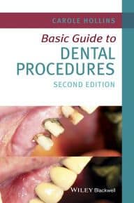 Basic Guide to Dental Procedures, 2nd Edition