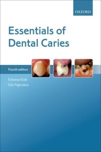 Essentials of Dental Caries, 4th Edition