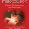 Malocclusion: Causes, Complications and Treatment