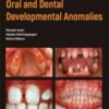 Atlas of Pediatric Oral and Dental Developmental Anomalies