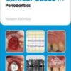 Clinical Cases in Periodontics