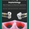 Decision Making in Dental Implantology: Atlas of Surgical and Restorative Approaches