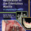 Esthetic Implant Restoration in the Edentulous Maxilla: A Simplified Protocol