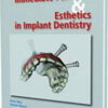 Immediate Function and Esthetics in Implant Dentistry