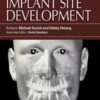 Implant Site Development