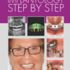 Implantology Step by Step, 2nd Edition