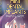 Mini Dental Implants: Principles and Practice