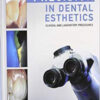 Precision in Dental Esthetics: Clinical and Laboratory Procedures