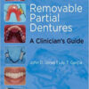 Removable Partial Dentures: A Clinician’s Guide