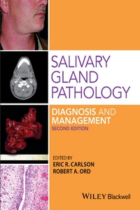 Salivary Gland Pathology: Diagnosis and Management, 2nd Edition