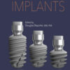 Short and Ultra-Short Implants