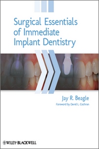 Surgical Essentials of Immediate Implant Dentistry