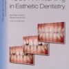 Tooth Whitening in Esthetic Dentistry: Principles and Techniques