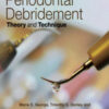 Ultrasonic Periodontal Debridement: Theory and Technique