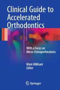 Clinical Guide to Accelerated Orthodontics