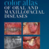 Color Atlas of Oral and Maxillofacial Diseases