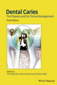 Dental Caries: The Disease and Its Clinical Management, 3rd Edition