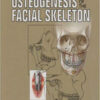 Distraction Osteogenesis of the Facial Skeleton