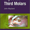 Impacted Third Molars, 1st Edition