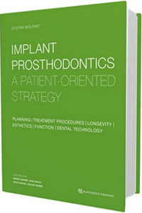 Implant Prosthodontics: A Patient-Oriented Strategy