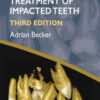 Orthodontic Treatment of Impacted Teeth, 3rd Edition