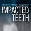 Orthodontic and Surgical Management of Impacted Teeth