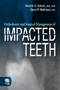 Orthodontic and Surgical Management of Impacted Teeth