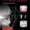 Orthodontics in the Vertical Dimension: A Case‐Based Review