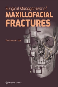 Surgical Management of Maxillofacial Fractures