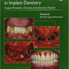 Immediate Loading in Implant Dentistry