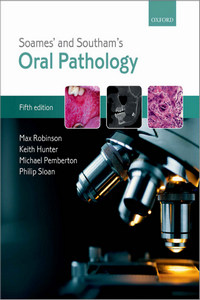 Oral Submucous Fibrosis: A Guide to Diagnosis and Management