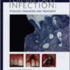 Peri-implant Infection: Etiology, Diagnosis and Treatment