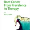 Root Caries: From Prevalence to Therapy