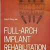 Full-Arch Implant Rehabilitation