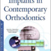 Implants in Contemporary Orthodontics