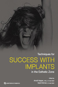 Techniques for Success With Implants in the Esthetic Zone