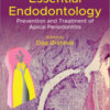 Essential Endodontology: Prevention and Treatment of Apical Periodontitis, 3rd Edition