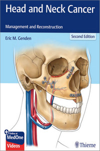 Head and Neck Cancer: Management and Reconstruction, 2nd Edition