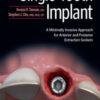 The Single-Tooth Implant