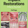 Implant Restorations: A Step-by-Step Guide, 4th Edition