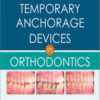 Temporary Anchorage Devices in Orthodontics, 2nd Edition