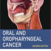 Oral and Oropharyngeal Cancer, 2nd Edition