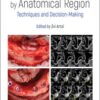 Bone Augmentation by Anatomical Region: Techniques and Decision-Making