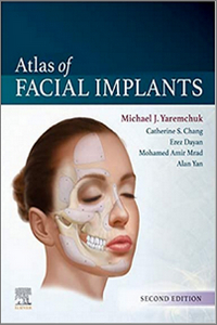 Atlas of Facial Implants, 2nd Edition