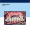 Guide to Periodontal Treatment Solutions for General Dentistry