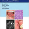 Oral Cancer: Evaluation, Therapy, and Rehabilitation