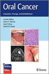 Oral Cancer: Evaluation, Therapy, and Rehabilitation