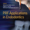 PRF Applications in Endodontics