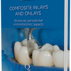 Composite Inlays and Onlays: Structural, Periodontal, and Endodontic Aspects