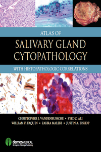 Atlas Of Salivary Gland Cytopathology With Histopathologic Correlations